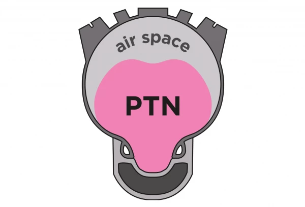 Mousse Anti-Pincement Pepi's Tire Noodle R-Evolution 29'' (Paire) 6 Mousse Anti-Pincement Pepi's Tire Noodle R-Evolution 29'' (Paire) – Image 4